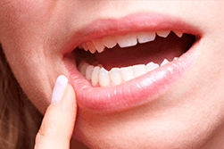Molars And Wisdom Teeth Explained