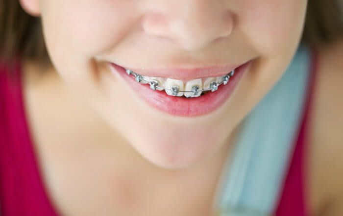 best pediatric dentist in Rockland County