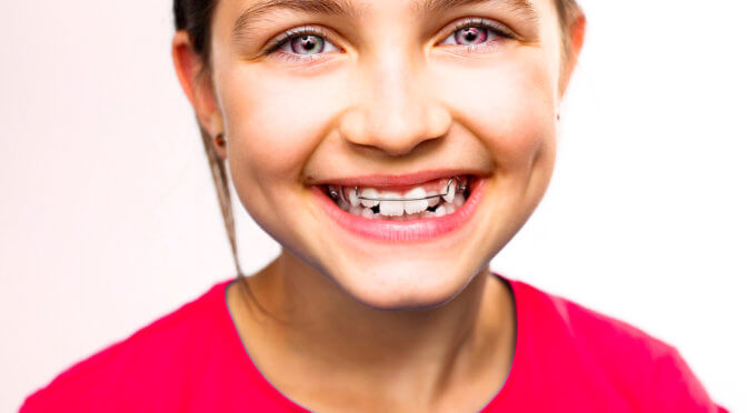 Does My Child Need Retainers?