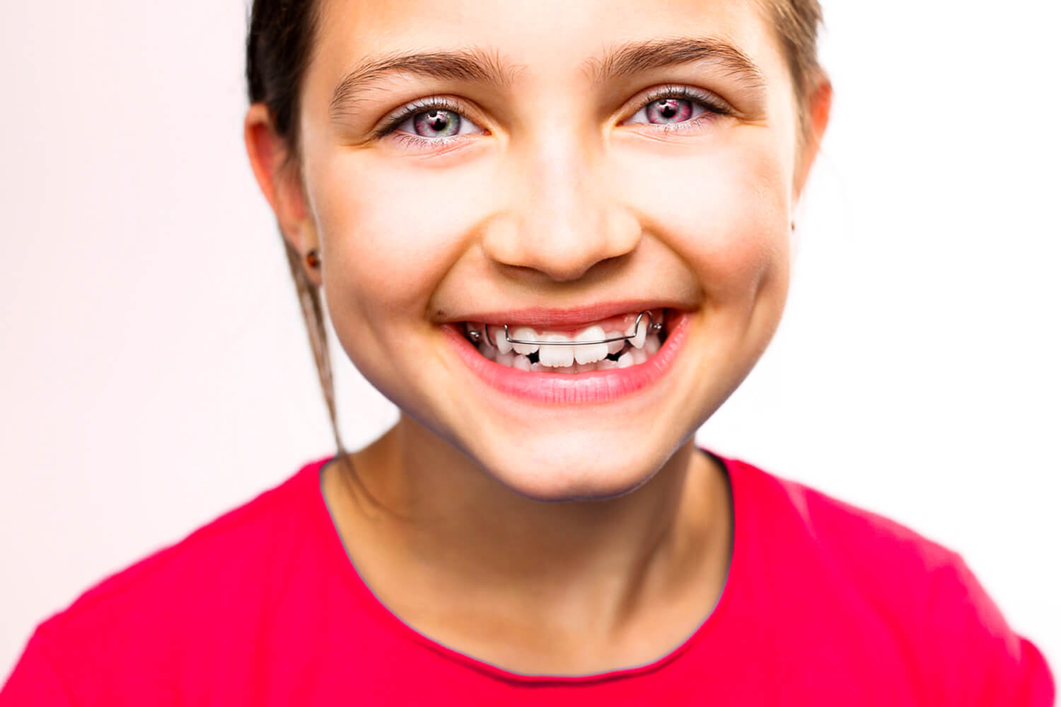 best pediatric dentist in Glen Rock