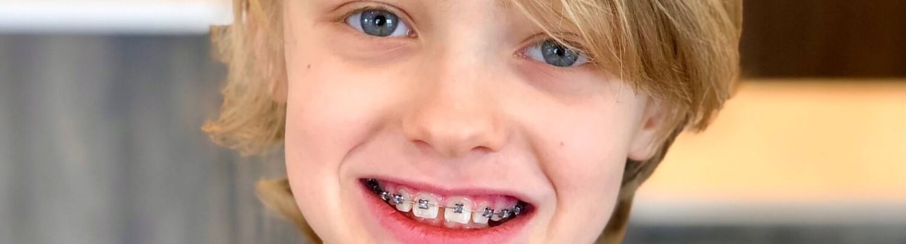 Orthodontic Treatments in Early Childhood 1