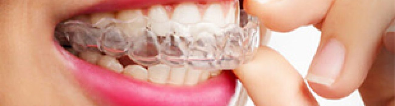 Orthodontist Wyckoff 2