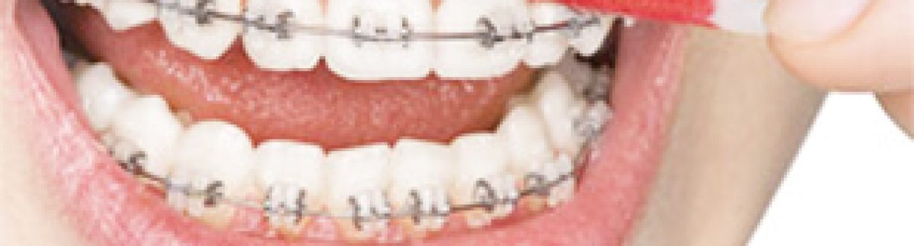 orthodontist Paramus